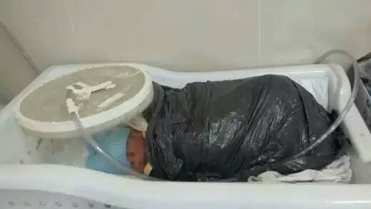 Por falta de manta térmica, equipe médica enrolou bebê em saco de lixo